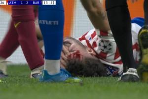 又血崩一个!鲁杰里被加维肘击倒地满脸是血,加维染黄